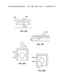 Surgical Tools for Arthroplasty diagram and image