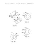 Surgical Tools for Arthroplasty diagram and image