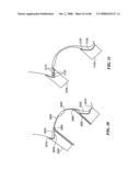 Surgical Tools for Arthroplasty diagram and image