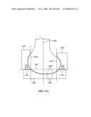 Surgical Tools for Arthroplasty diagram and image