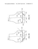 Surgical Tools for Arthroplasty diagram and image