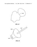 Surgical Tools for Arthroplasty diagram and image