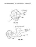 Surgical Tools for Arthroplasty diagram and image