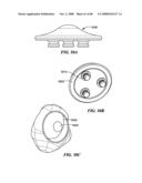 Surgical Tools for Arthroplasty diagram and image