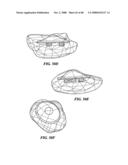 Surgical Tools for Arthroplasty diagram and image