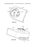 Surgical Tools for Arthroplasty diagram and image