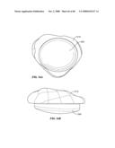 Surgical Tools for Arthroplasty diagram and image