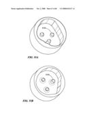 Surgical Tools for Arthroplasty diagram and image