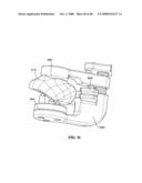 Surgical Tools for Arthroplasty diagram and image