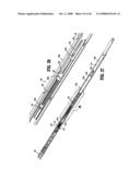 ENDOSCOPIC SURGICAL CLIP APPLIER diagram and image