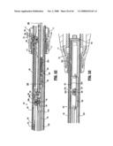 ENDOSCOPIC SURGICAL CLIP APPLIER diagram and image