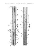 ENDOSCOPIC SURGICAL CLIP APPLIER diagram and image