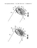 ENDOSCOPIC SURGICAL CLIP APPLIER diagram and image