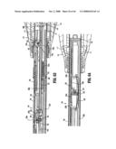 ENDOSCOPIC SURGICAL CLIP APPLIER diagram and image