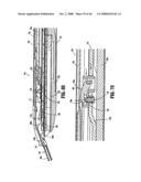 ENDOSCOPIC SURGICAL CLIP APPLIER diagram and image