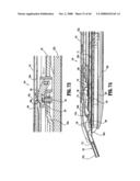 ENDOSCOPIC SURGICAL CLIP APPLIER diagram and image