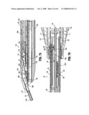 ENDOSCOPIC SURGICAL CLIP APPLIER diagram and image