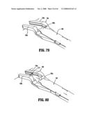 ENDOSCOPIC SURGICAL CLIP APPLIER diagram and image