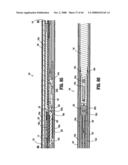 ENDOSCOPIC SURGICAL CLIP APPLIER diagram and image