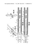 ENDOSCOPIC SURGICAL CLIP APPLIER diagram and image