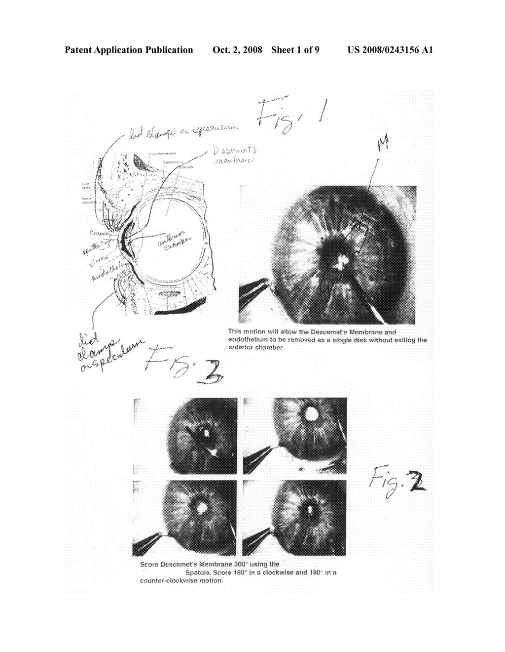Ophthalmic surgical instrument & surgical methods - diagram, schematic, and image 02