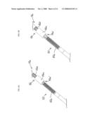 IN-LINE ROD REDUCTION DEVICE AND METHODS diagram and image