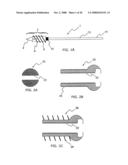 Adjustable bone plate fixation system and metho diagram and image