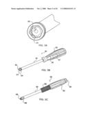 Adjustable bone plate fixation system and metho diagram and image