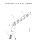 Adjustable bone plate fixation system and metho diagram and image