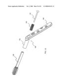 Adjustable bone plate fixation system and metho diagram and image