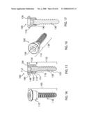 Adjustable bone plate fixation system and metho diagram and image