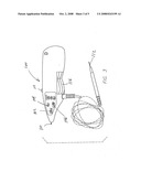 Electrical stimulus allergy treatment method diagram and image