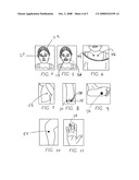 Electrical stimulus allergy treatment method diagram and image