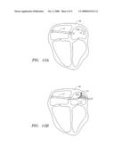 HIGH RESOLUTION ELECTROPHYSIOLOGY CATHETER diagram and image