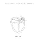 HIGH RESOLUTION ELECTROPHYSIOLOGY CATHETER diagram and image