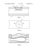 CELLULAR TRANSPLANT STENT diagram and image