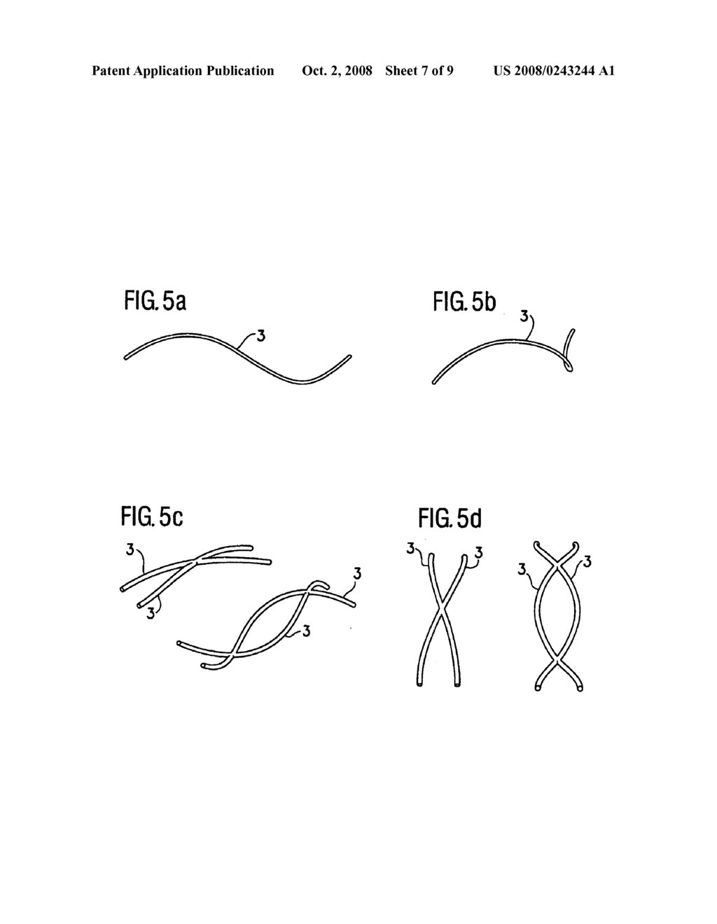 Metallic Endoprosthesis Compatible with Magnetic Resonance - diagram, schematic, and image 08