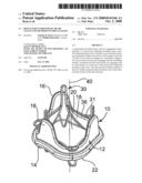 Replacement prosthetic heart valves and methods of implantation diagram and image