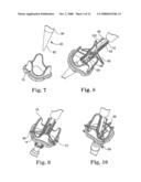 Replacement prosthetic heart valves and methods of implantation diagram and image