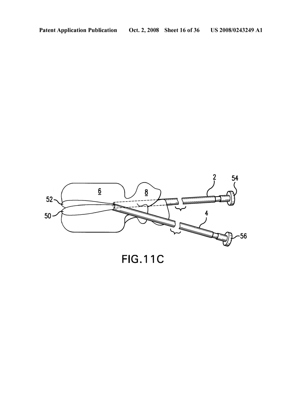 Devices for multipoint emplacement in a body part and methods of use of such devices - diagram, schematic, and image 17