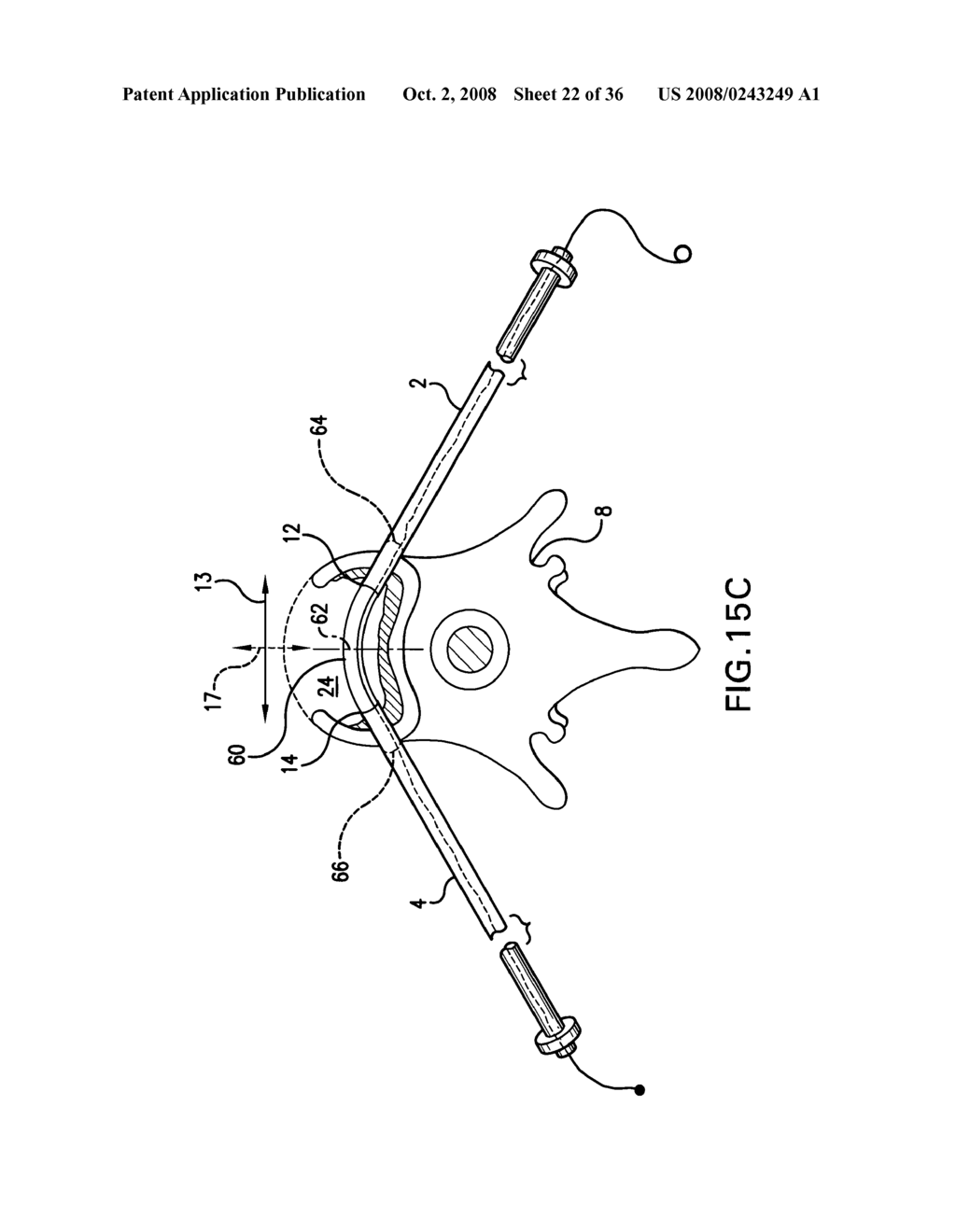 Devices for multipoint emplacement in a body part and methods of use of such devices - diagram, schematic, and image 23