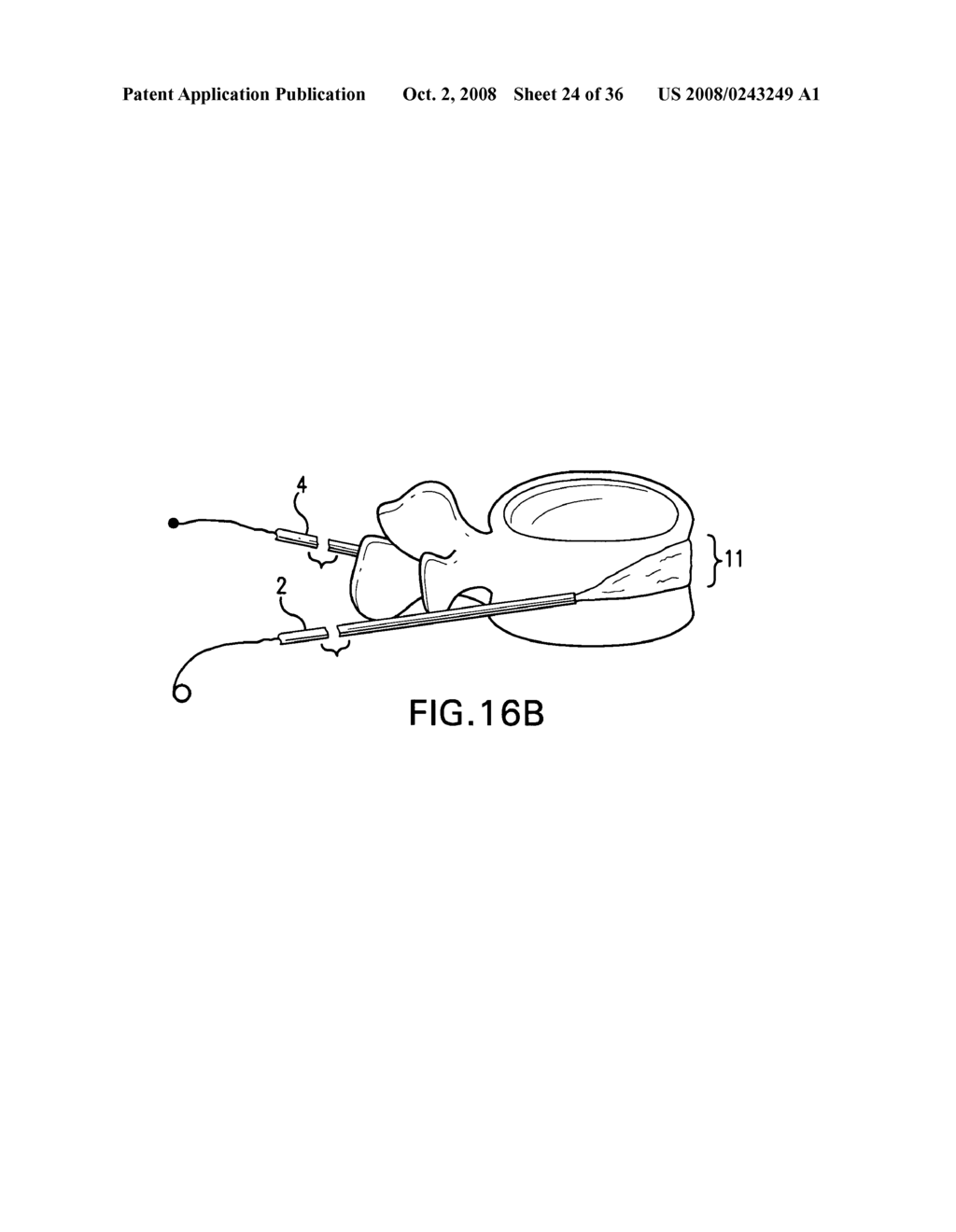 Devices for multipoint emplacement in a body part and methods of use of such devices - diagram, schematic, and image 25