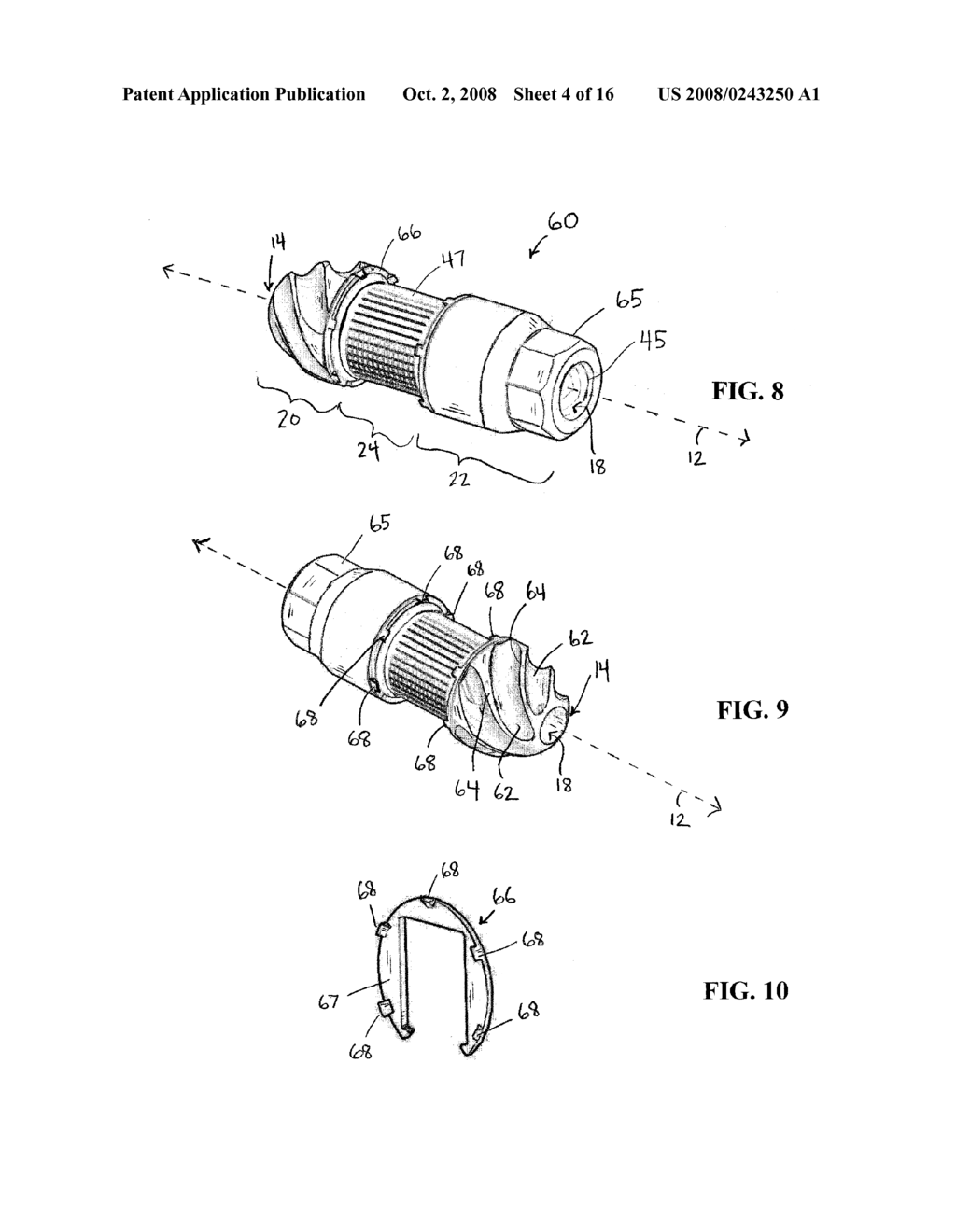 Lateral Spinous Process Spacer - diagram, schematic, and image 05