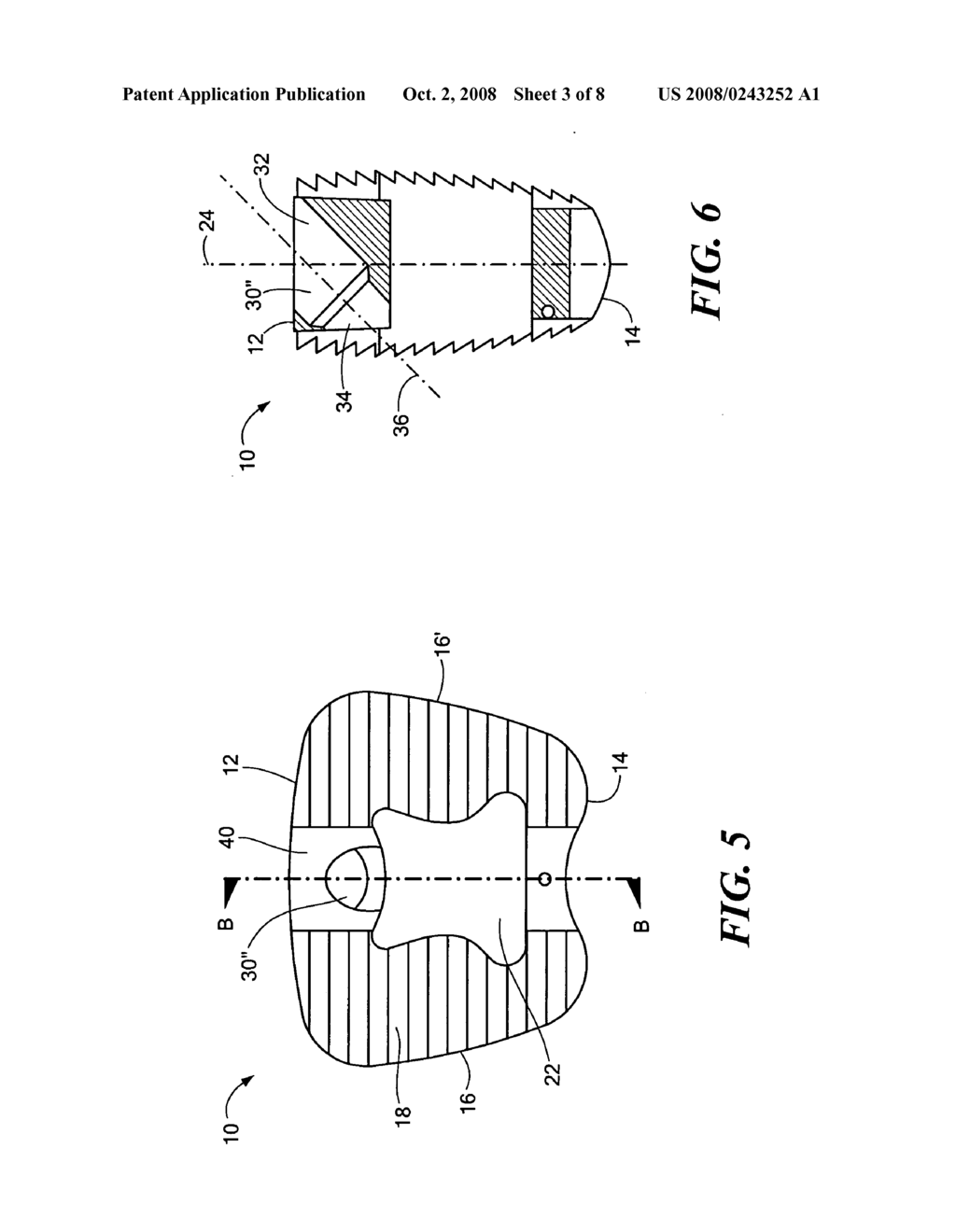 Spinal implant system - diagram, schematic, and image 04