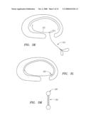 DEVICES USED TO TREAT DISC HERNIATION AND ATTACHMENT MECHANISMS THEREFORE diagram and image