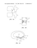 DEVICES USED TO TREAT DISC HERNIATION AND ATTACHMENT MECHANISMS THEREFORE diagram and image