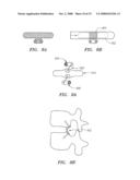 DEVICES USED TO TREAT DISC HERNIATION AND ATTACHMENT MECHANISMS THEREFORE diagram and image