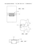 DEVICES USED TO TREAT DISC HERNIATION AND ATTACHMENT MECHANISMS THEREFORE diagram and image