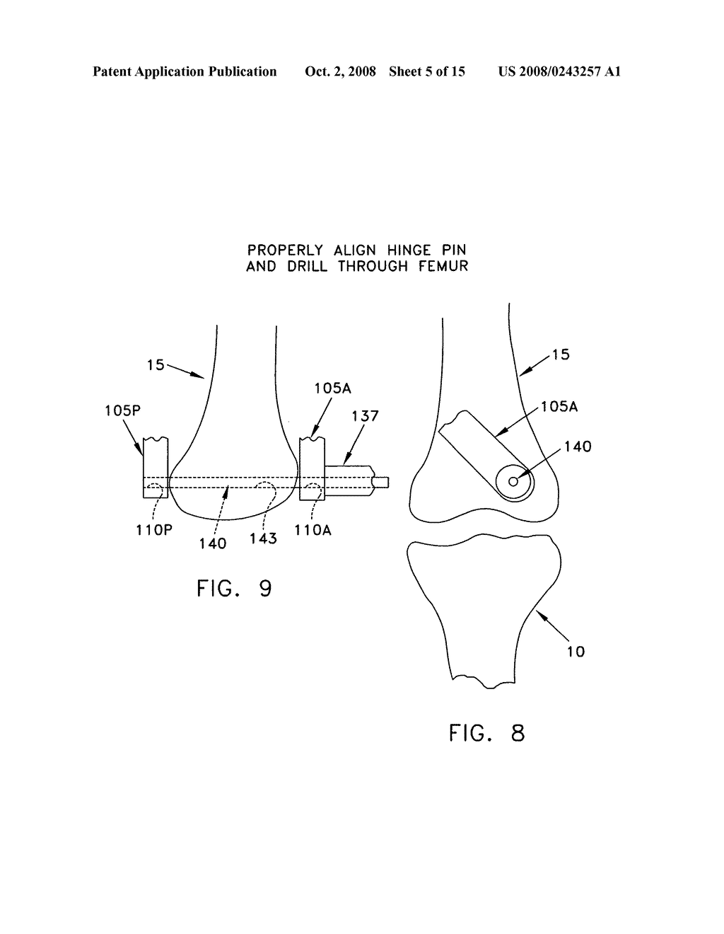 Method and apparatus for performing an open wedge, low femoral osteotomy - diagram, schematic, and image 06