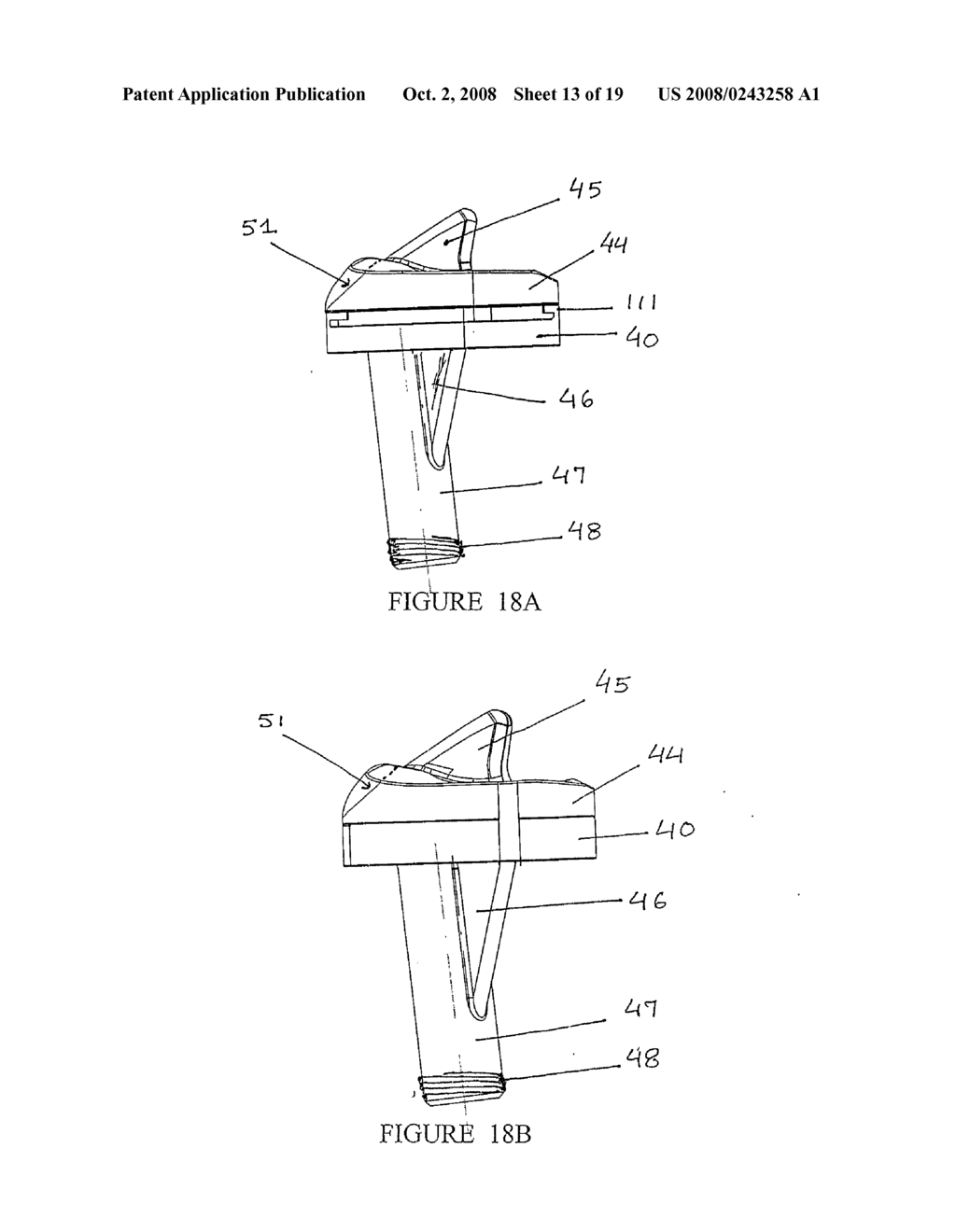 Knee Joint Prosthesis - diagram, schematic, and image 14